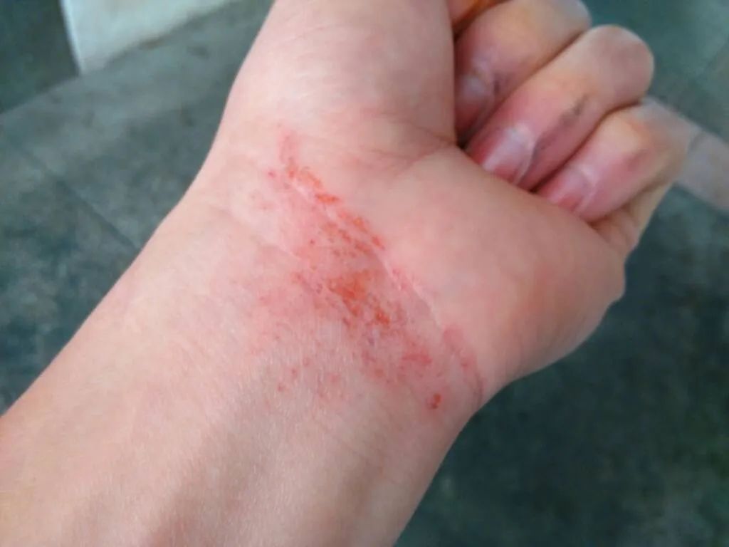 1592545755707973.jpg 1592545755707973.jpg